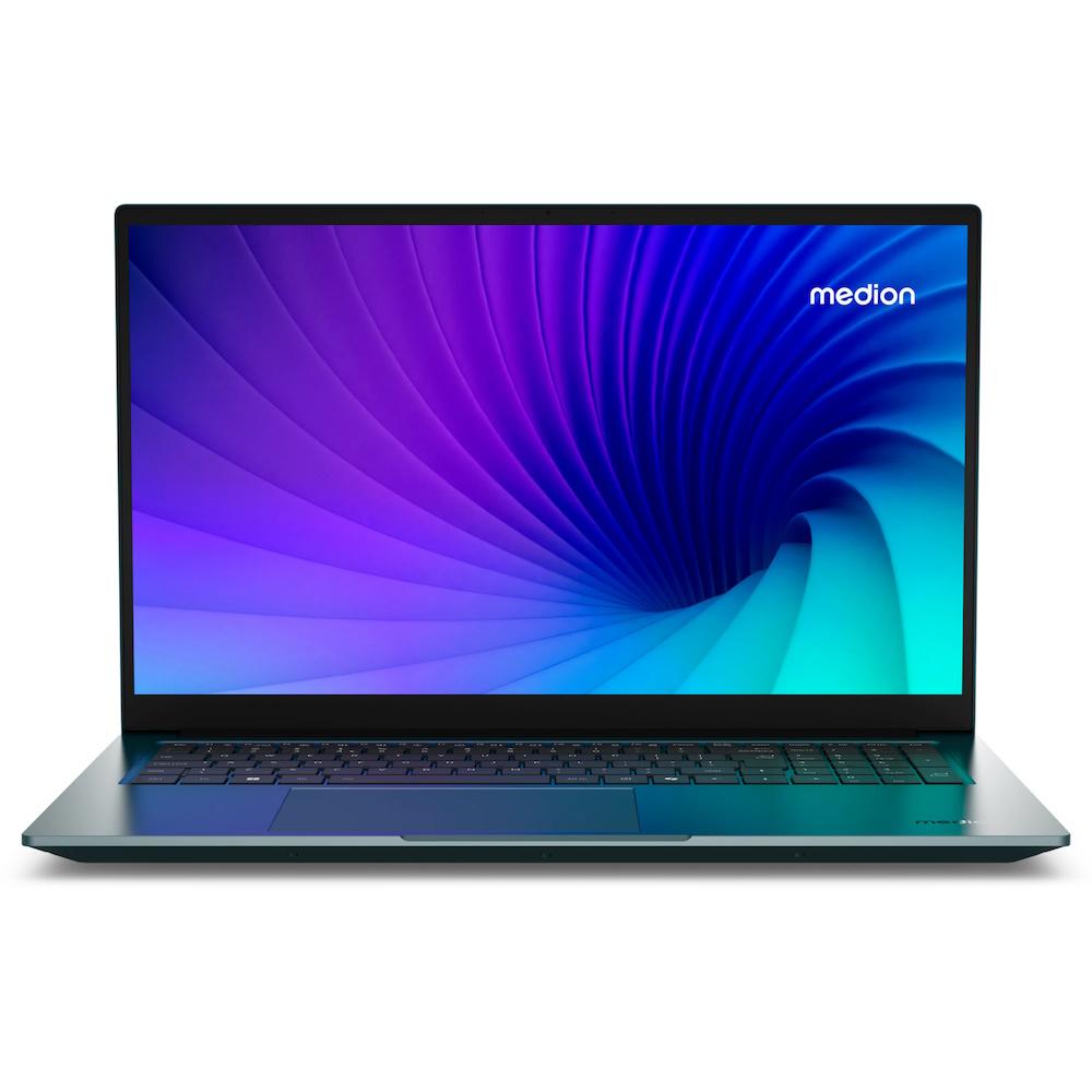 Bærbar Computer Medion S20 Ultra 155h Windows Home på Afbetaling